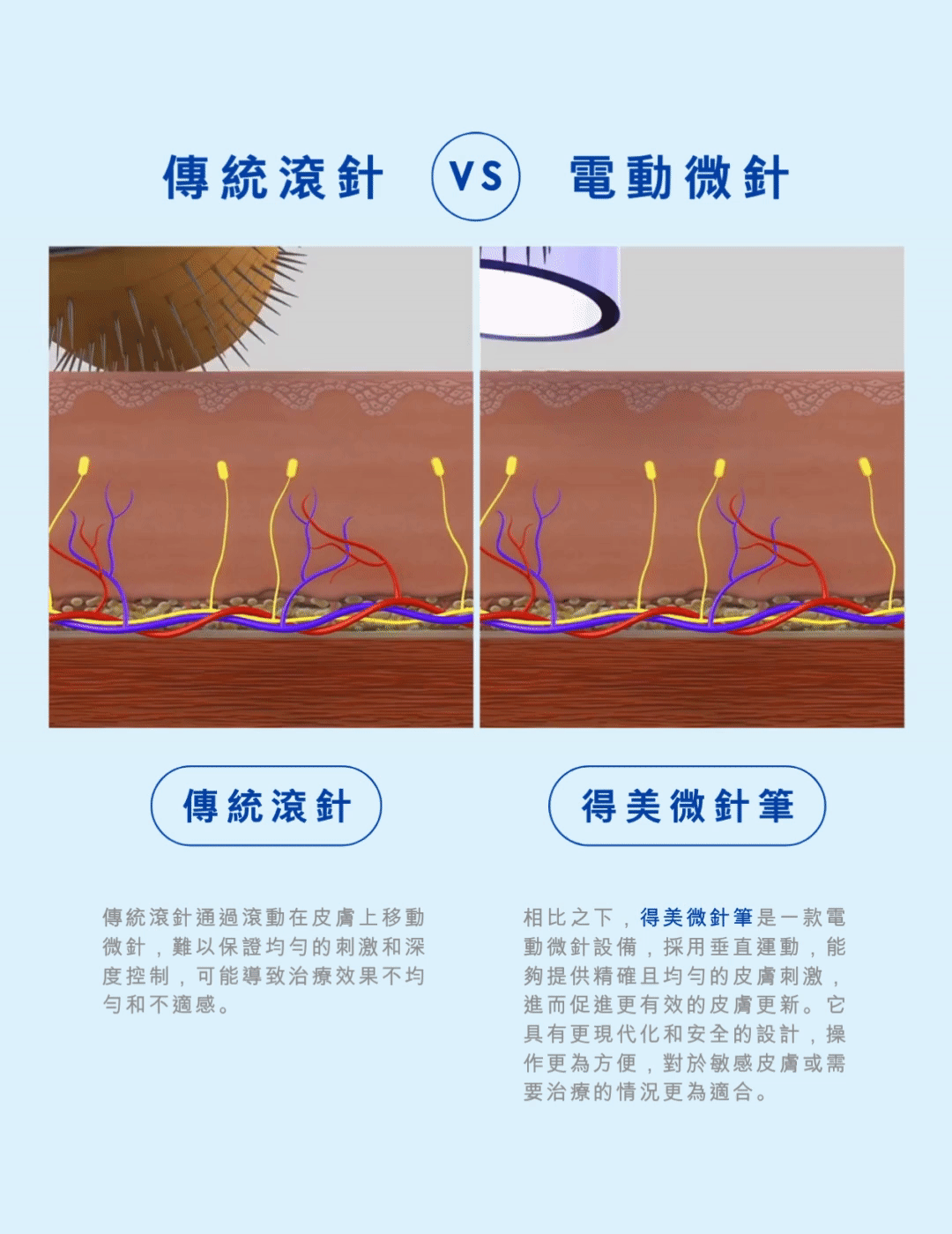 比較圖