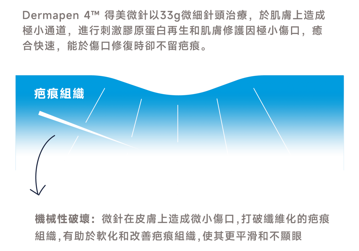 治療方式圖