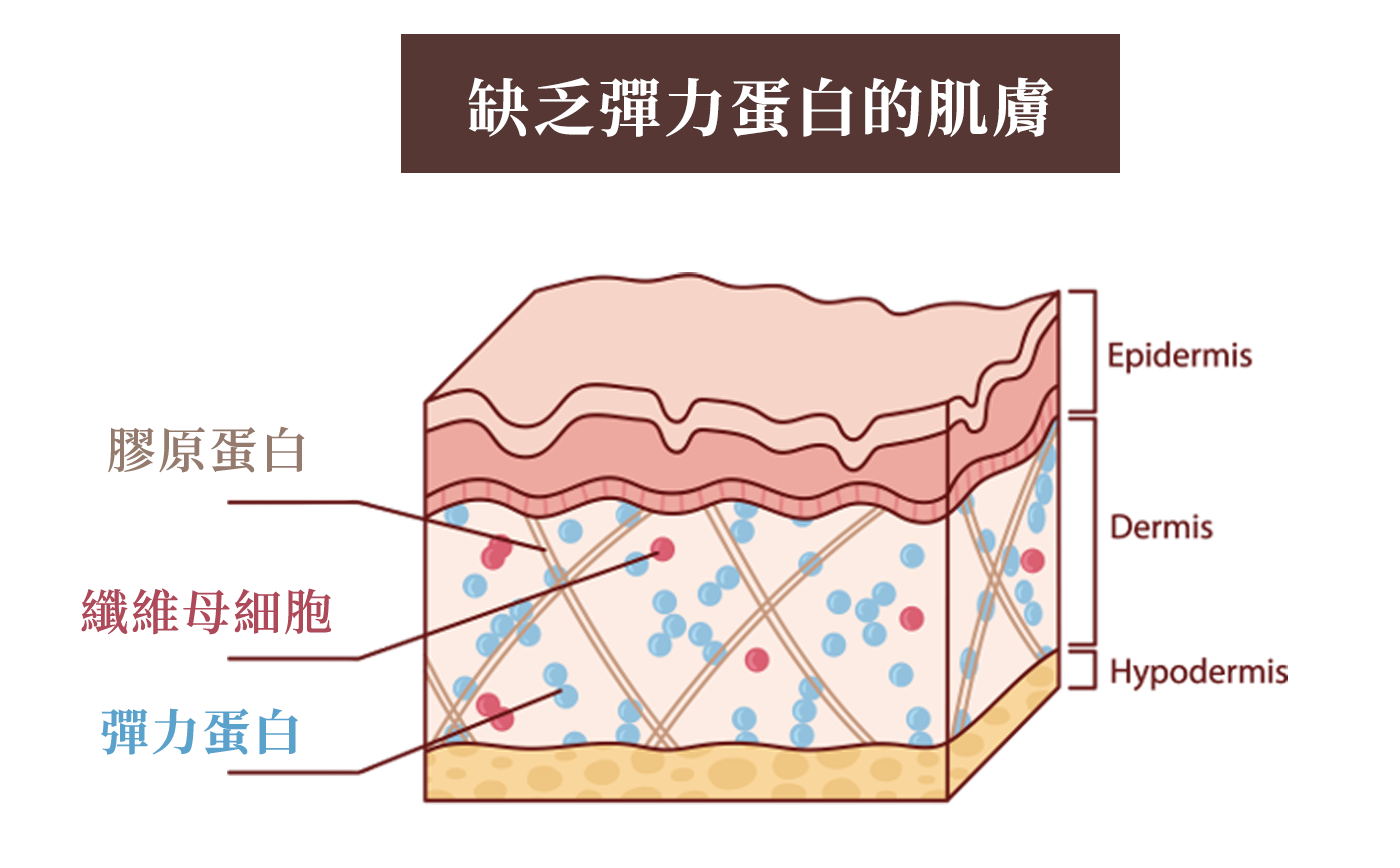 缺乏彈力蛋白的肌膚