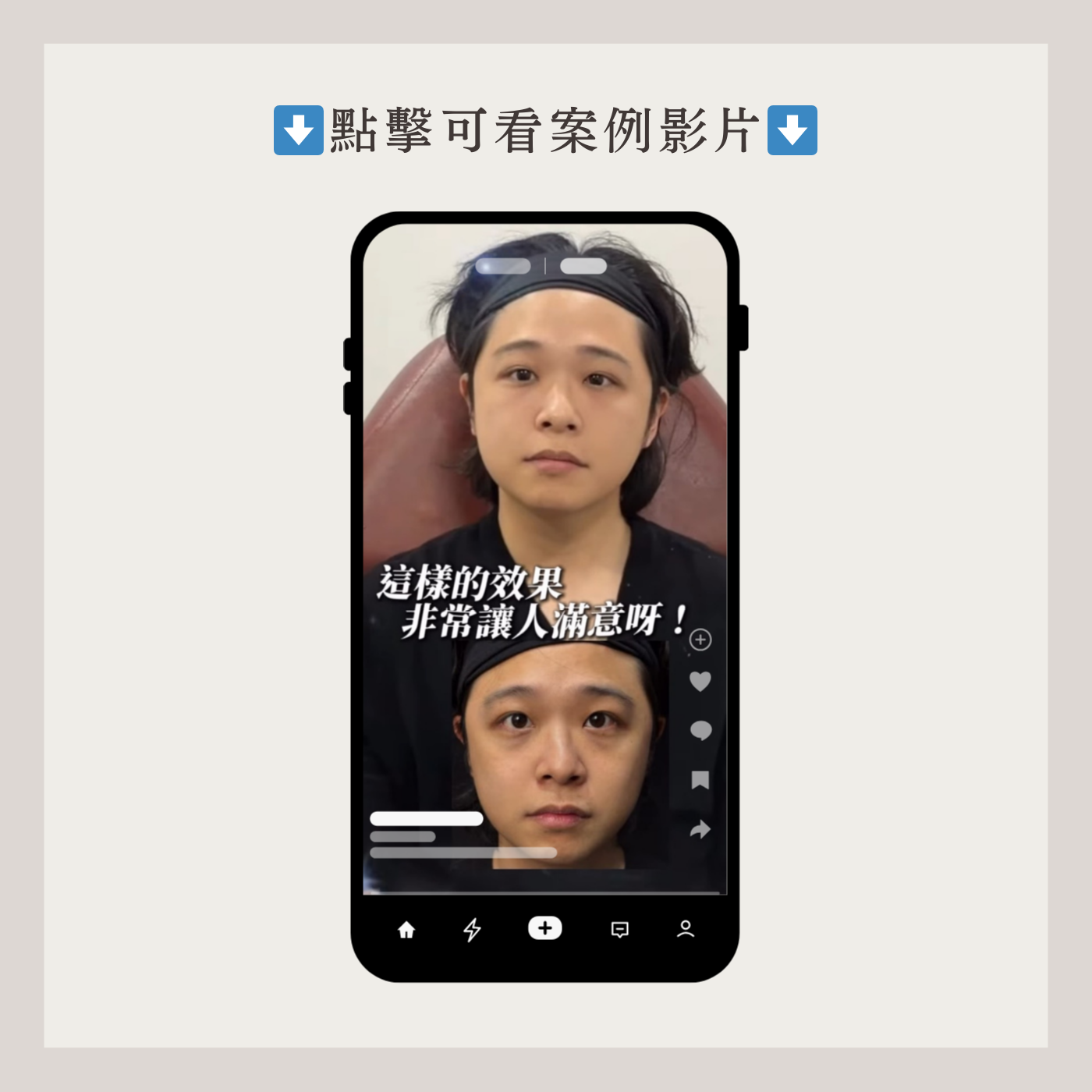 妮芙蕾影片案例1