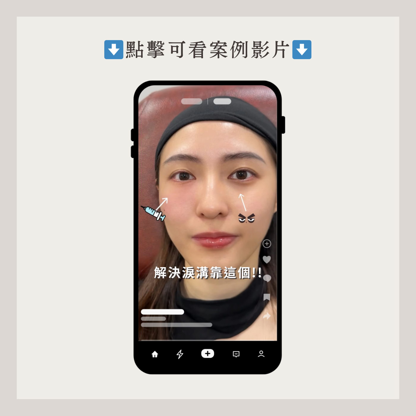 妮芙蕾影片案例2